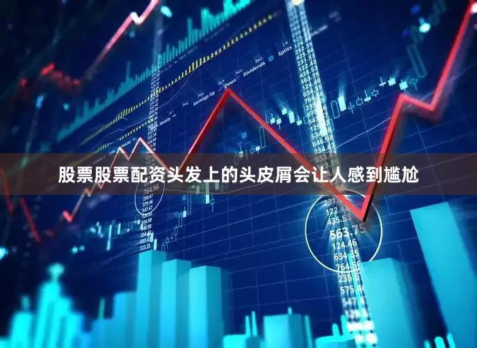 股票股票配资头发上的头皮屑会让人感到尴尬